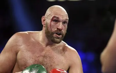 Tyson Fury vs. Dillian Whyte Fight Odds & Picks